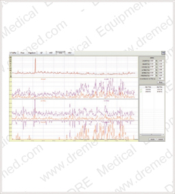 DRE Sage 12c obstructive sleep apnea analysis